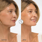 MAREE V Line Lifting Mask with Hyaluronic Acid – Deep Collagen Face Mask for Women – Jawline Shaper Facial Masks with Retinol – Tightening & Firming Neck Lift Tape – Double Chin Strap for Face Lift