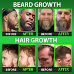 GROW Beard Oil Serum + Biotin Beard Growth Gummies – Beard Growth Kit for Men with 620,000mcg Biotin, Collagen, MSM & Keratin – Thickens Beard, Fills Patches & Supports Hair Growth