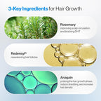 Be Bodywise Rosemary Hair Growth Serum Roll On 50 ml – 3% Rosemary, 3% Redensyl & 2% Anagain | DHT-Blocking Scalp Serum Boosts Oxygen Flow, Reduces Hair Fall | Paraben/Sulfate-Free | Women & Men