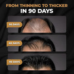 SPARTAN™ Root Activator Shampoo For Men - Hair Growth Shampoo for Hair Loss and Thinning Hair
