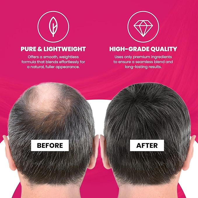 VELO Hairline Powder–DARK BROWN Hair Root Touch Up Powder for Women & Men–Instantly Covers Gray Hair, Thinning Hair & Bald Spots–Sweatproof Root Cover Up–Puff & Mirror Compact, 13 Shades