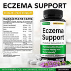 Greenford Eczema Treatment & Support for Natural Relief - Made in USA - Skin Vitamins & Herbals for Eczema, Acne, Psoriasis, Rosacea Treatment with Zinc, Niacinamide & Probiotics - 60 caps