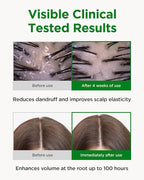 CKD Amino Biotin All powerful Treatment (5.07 fl.oz) - Deep Care Conditioner and Silicone-Free Treatment, Prevents Damaged Hair, Nourishihes Hair, Non-Silicone with Biotin, Amino Acids, and Keratin.