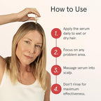 iRESTORE Scalp Serum | Hair Growth Serum for Women Men | Best for Hair Loss Hair Thinning | Aids Regrowth with Redensyl Capixyl & Biotin | Hydrates Scalp for Visibly Thicker Fuller Hair - 2 Fl Oz