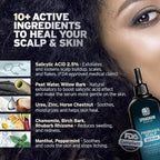 Sphagnum Botanicals Scalp Psoriasis Treatment Serum - Herbs & Medicated salicylic Acid Quickly Relieve a red, Flaky & Itchy Scalp. Effective for Eczema, Dandruff and seborrheic Dermatitis 1.7 fl. Oz