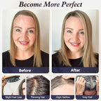 starluck Real Human Hair Toppers for Women 10 Inch Human Hair Topper no Bangs, 3 * 4.5 inches Swiss Base Suitable for ThinningHair Cover Grey Roots(Ombre P721A#)