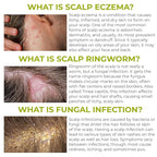 Folliculitis Shampoo | Antifungal Shampoo for Seborrheic Dermatitis, Scalp Psoriasis & Dandruff | Soothes Itchy, Dry Scalp | Cleanses, Exfoliates & Removes Build-Up | Reactivates Hair Follicles