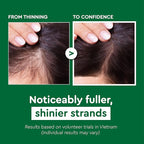 Vietnam's Touch | COCAY HOALA Polygonum Multiflorum 2in1 Herbal Shampoo – Strengthen Weak Roots, Reduce Hair Fall, Revive Lifeless Hair, Deeply Nourish & Soften – Paraben Free (14.8 oz)