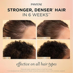 Pantene Abundant & Strong 3-Piece Regimen with B5 Complex + Niacinamide, Shampoo (13.5 oz), Conditioner (8 oz), Serum (2 oz) for Hair Loss, Thinning, Anti-Breakage, Volume - Grows Healthier