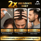 Elevate Hair Regrowth Treatment 5% Minoxidil Spray for Men - Clinically Proven Formula Fast Absorbing for Hair Loss and Growth Unscented Topical Hair Spray for Thinning & Balding Hair - Made in USA