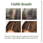 ALFHEIM Saw Palmetto Scalp Serum to Strengthen Follicles | With Caffeine & Biotin for Fuller Hair | Helps Balance Scalp, Revive Hair Roots & Enhance Hair Density | 0.34 fl oz + Serum Applicator