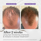 Dr. Groot Scalp Revitalizing Solution Travel Set for Hair Loss, Korean Hair Care, Hair Thickening Shampoo & Miracle in Shower Treatment, TSA Approved, 5 Seconds to Smooth Hair, Rosemary Oil