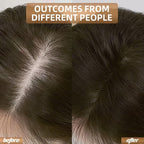 Red Light Therapy for Hair Growth, Quick-Release Panels & Portable Design, Laser Hair Growth Cap, Hair Loss Treatments Hat