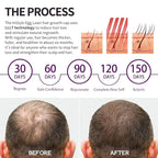Instyle Egg Laser Hair Growth Cap – 80 Medical-Grade Diodes, FDA Cleared LLLT Red Light Therapy for Hair Regrowth & Thicker Hair, Hair Loss Treatment for Men & Women