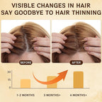 Hair Growth Spray, Natural Hair Growth Serum for Women With Rosemary Oil and Biotin Hair Oils, Prevent Hair Thinning & Anti-Hair Loss Treatment for Women & Men, Non-Greasy, 60ml Bottle