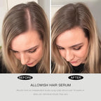 Hair Growth Serum 95 ml - Rosemary Hair Thickening Serum with Biotin, Caffeine for Hair Thinning & Shedding – Promotes Healthy Scalp, Fuller, Nourish, Strengthens Roots