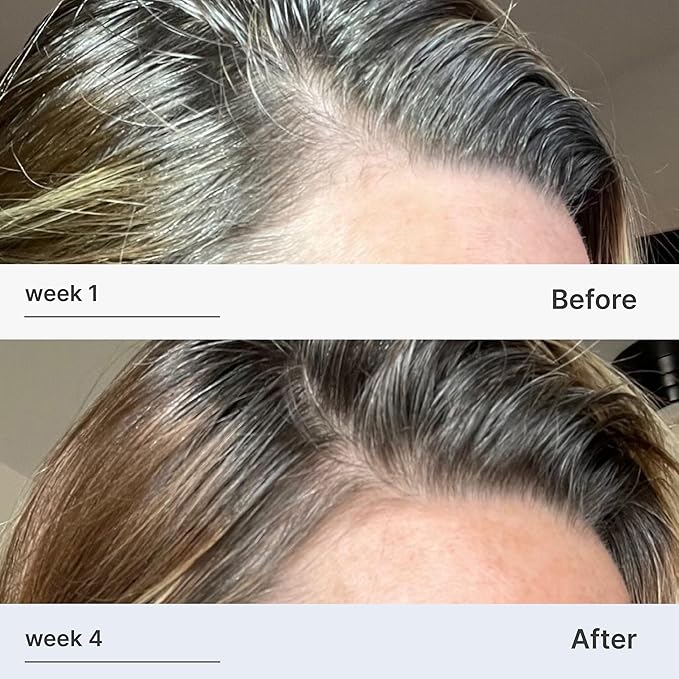 Better Not Younger Superpower Serum & Liquid Comb Bundle – Hair Growth Serum with Scalp Massaging Applicator for Thinning, Aging Hair – Fuller, Stronger Hair for Women Over 40