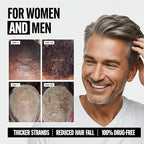 Tru Bloom Hair Growth Vitamins - 1 Month Supply. Clinically Proven to Grow Fuller, Thicker Hair. Drug-Free with Biotin, Collagen, Keratin, MSM, Zinc, D3 + Hair Superfoods