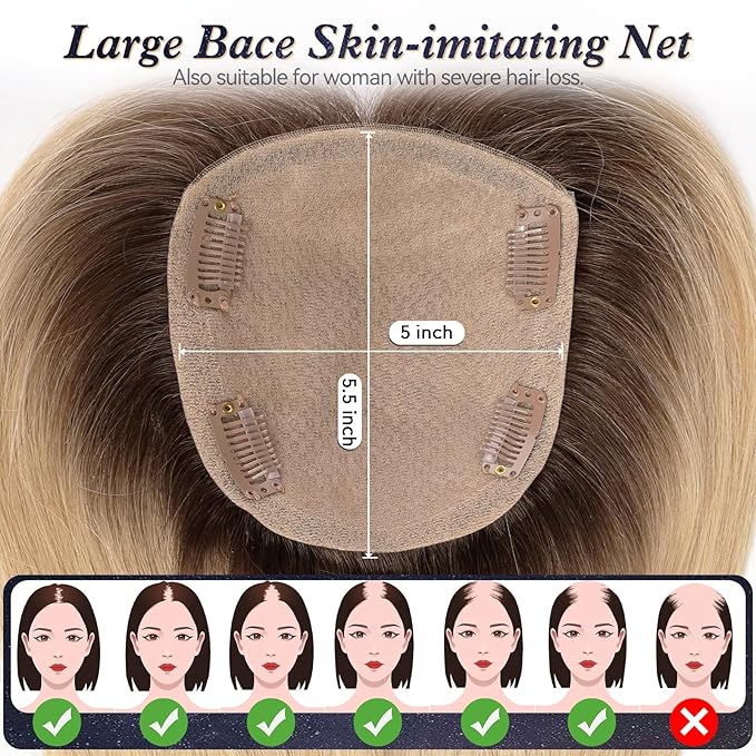 starluck Hair Toppers for Women with Bangs, 5"*5.5"Large Coverage Ombre Light Blonde 100% Real Human Hair Toppers for Women with ThinningHair,Cover Gray Roots