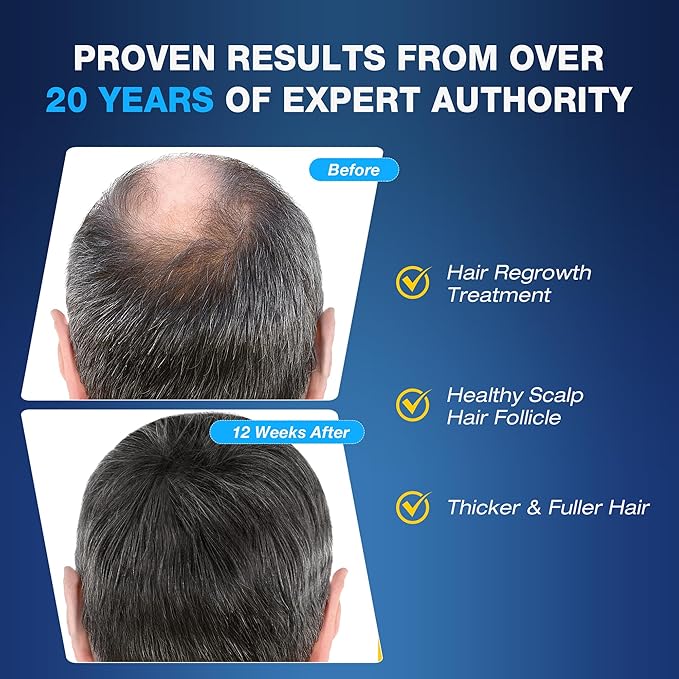 5% Minoxidil for Men Foam Hair Growth - Minoxidil Foam Hair Regrowth Treatment for Men, Topical Hair Loss Treatments, Extra Strength Thicker & Fuller Hair (2.11 Ounce x 2)