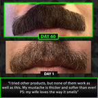GROW Beard Growth Serum + 2X Biotin Beard Balm – Thickening Conditioner with Castor Oil & Meadowfoam – Fills Patches, Boosts Growth, Softens & Styles – For Thicker, Fuller Men's Facial Hair