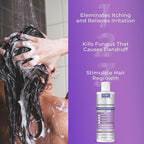 Anti Fungal Shampoo for Men & Women | Anti Dandruff, Medicated, Folliculitis Shampoo for Dry Scalp, Psoriasis, Ringworm | for Itchy, Flaky & Irritated Scalp | No Paraben & Sulphate