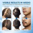 Rosemary Scalpy Hair Growth Serum Roll On, Hair Revival Ampoule, Hair Regrowth Roller for Fuller, Thicker, Stronger Hair, Repair Hairline & Thinning Hair for Men & Women (2 Pack)