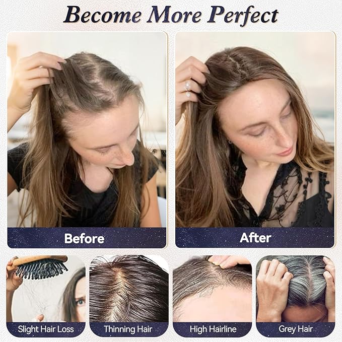 starluck Real Human Hair Toppers for Women 10 Inch Human Hair Topper no Bangs, 3 * 4.5 inches Swiss Base Suitable for ThinningHair Cover Grey Roots(Medium Brown and Honey Blonde Mix)