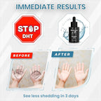 Truth Guy RU58841 10% Hair Serum for Men – Powerful DHT Blocker with Maximum Strength – Targets Male Pattern Thinning and Receding Hairline – Promotes Fuller, Healthier-Looking, Stronger Hair – 30 ml
