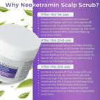 Anti Fungal Scrub for Men & Women | Anti Dandruff, Medicated, Folliculitis Scrub for Dry Scalp, Psoriasis, Ringworm | for Itchy, Flaky & Irritated Scalp
