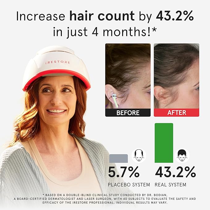 iRestore Professional Laser Red Light Therapy for Hair Growth System - FDA Cleared Hair Loss, Hair Thinning & Alopecia Treatment for Men & Women - 282 Lasers & LEDs