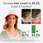 iRestore Professional Laser Red Light Therapy for Hair Growth System - FDA Cleared Hair Loss, Hair Thinning & Alopecia Treatment for Men & Women - 282 Lasers & LEDs
