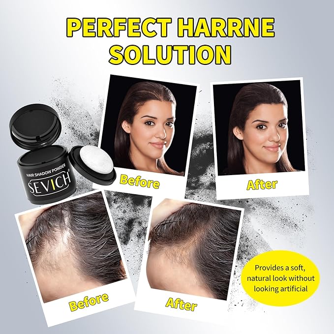 Sevich Hairline Powder 10g with Brush, Instantly Conceals Hair Loss & Thinning & Gray, 48H Waterproof Root Touch Up Powder, Natural Hair Shadow Toppers for Women & Men, 1 Box = 2.5 Boxes,Light Brown