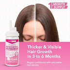 Minoxidil Foam for Women 5% Percent - Women's Hair Growth Treatment for Her - Topical Foaming Minoxidil for Women - Great for Hair Regrowth and Reduce Hair Loss - 1 Pack as 1 Month Supply