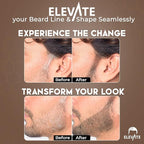 ELEVATE Hair Line Powder Instantly Conceal Hair Loss for Thinning Areas - Shadow Makeup - Root Cover Touch Up with Puff Touch - Instant Gray Coverage for Men and Women (Medium Brown)
