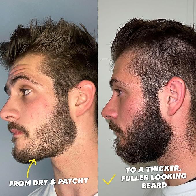 The Beard Club Signature Beard Growth Kit - Derma Roller, Beard Growth Oil, Beard Growth Vitamins, Vitamin Spray & Beard Brush - Gift Set
