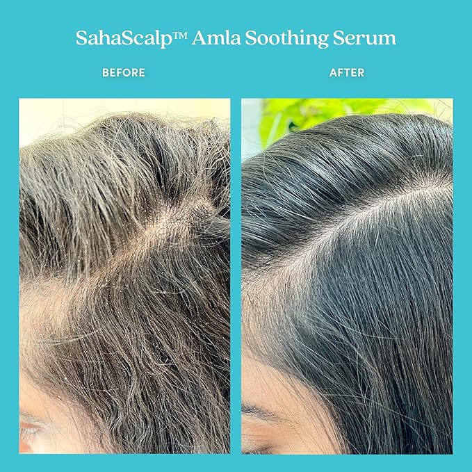Fable & Mane Amla Soothing Serum with Rosemary Oil Purifies and Balances Irritation. Detox Treatment for Dry, Itchy or Sensitive Scalps